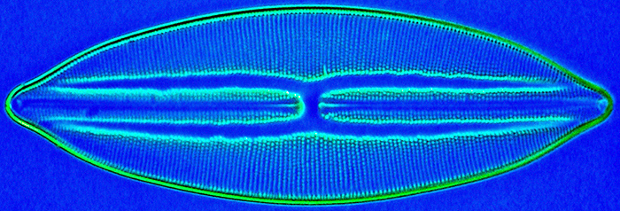 Diatom under Rheinberg illumination