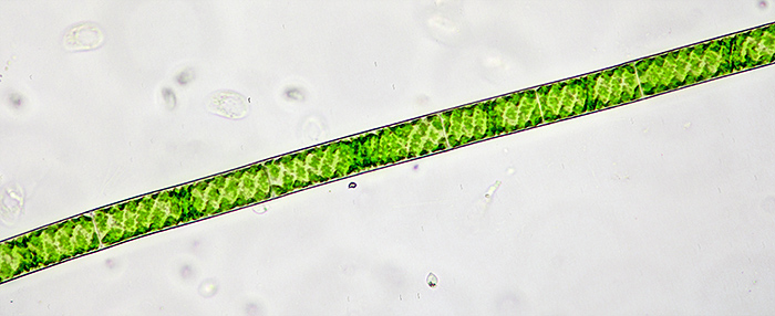 Single filament of Spirogyra