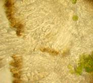 Spores of lichen