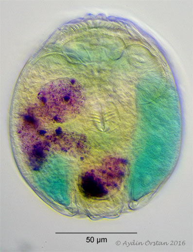 Philodina vorax contracted