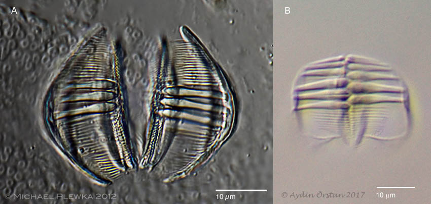 Trophi of Dissotrocha macrostyla and Abrochtha cf. sonneborni