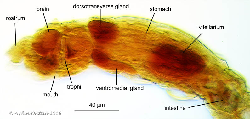 Abrochtha cf. sonneborni lateral view