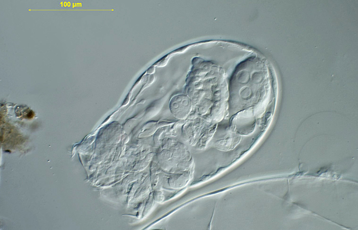 Asplanchna (a rotifer)