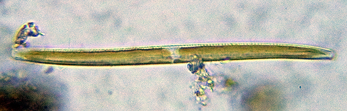 Unidentified diatom