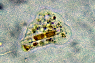 Amoeba with ingested diatom