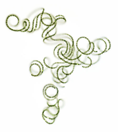 Cyanobacteria (Dolichospermum)
