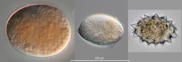 Eggs of bdelloid rotifers