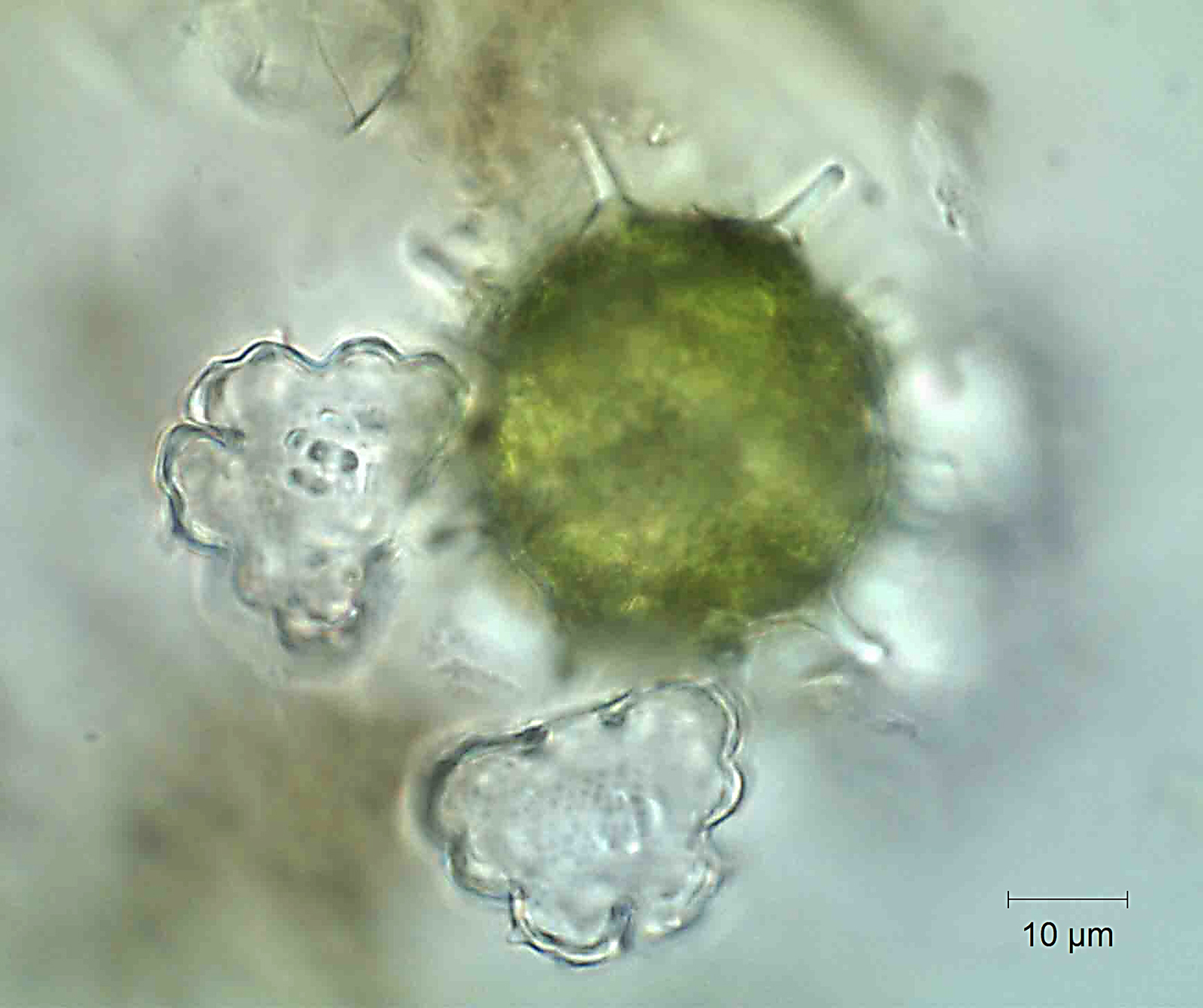 Euastrum zygospore (2)