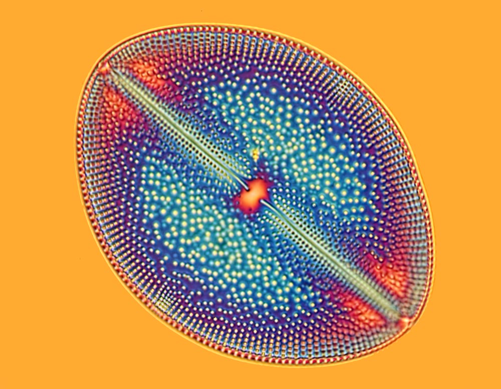 Navicula diatom
