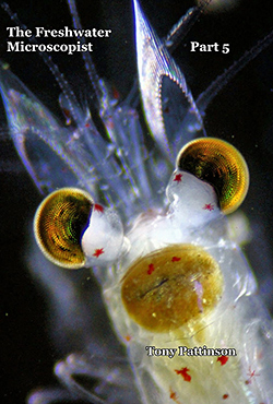 The Freshwater Microscopist Part 5 by Tony Pattinson