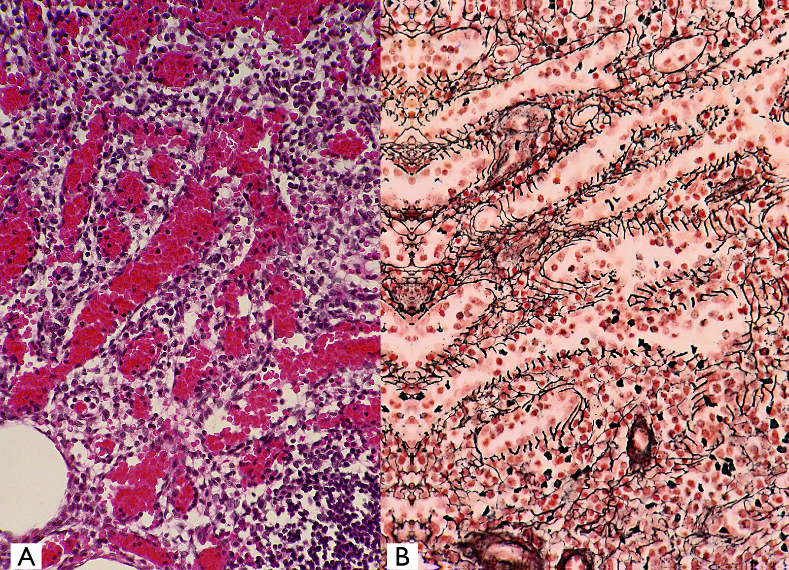 Mammalian Spleen - Histology sections compared