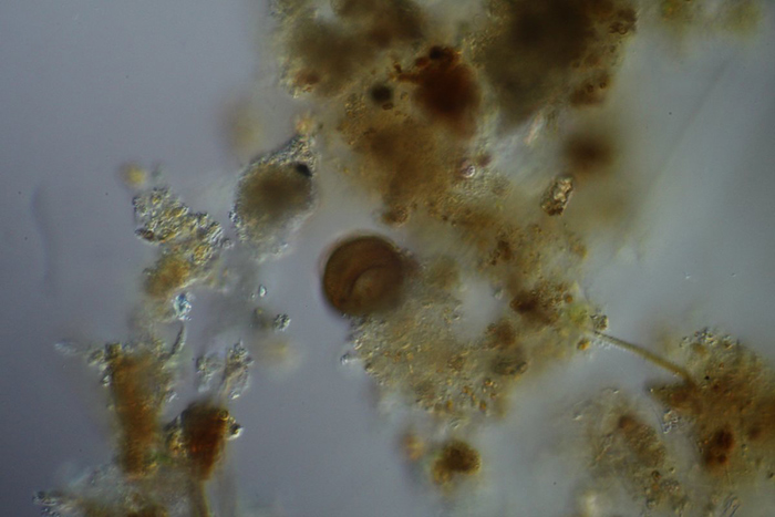 Test of Arcella sp.