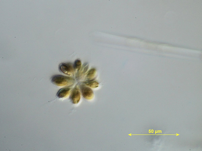 Chrysophyceae: Synura sp.