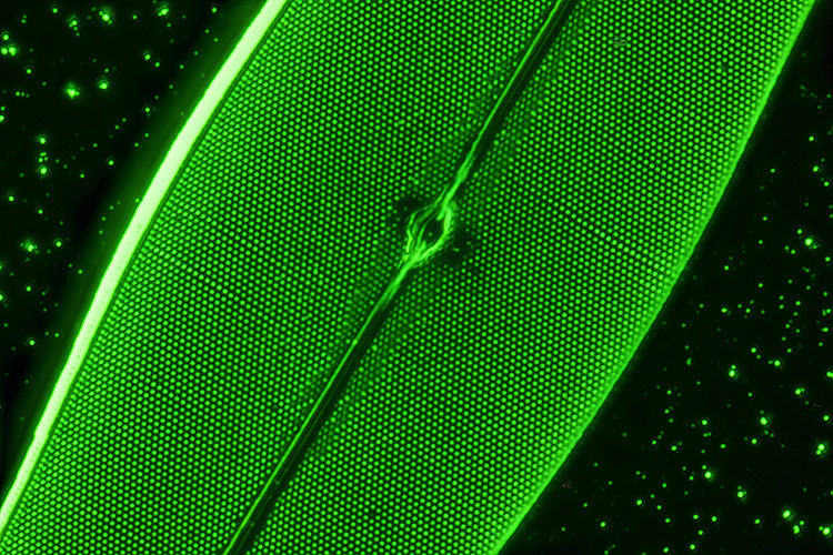<i>Pleurosigma angulatum</i> diatom by John Dale.