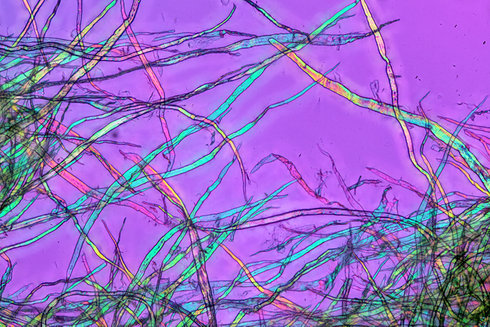 Teased tissue using crossed polarisers plus retarder