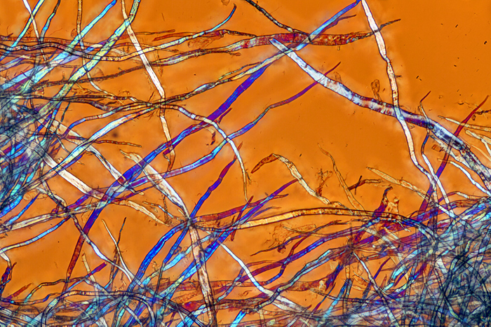 Teased tissue using crossed polarisers plus retarder