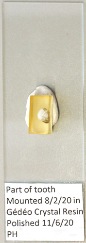 Tooth section