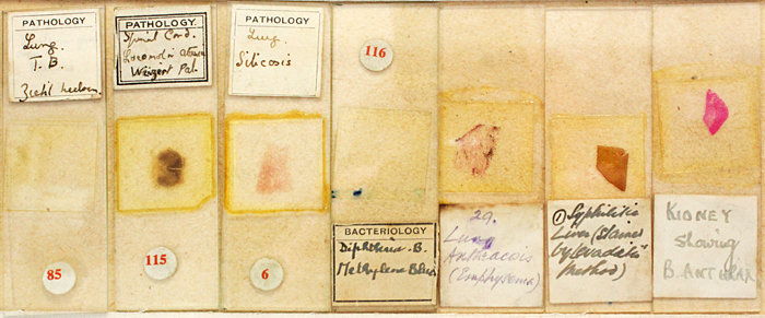 Terry Hope’s slides