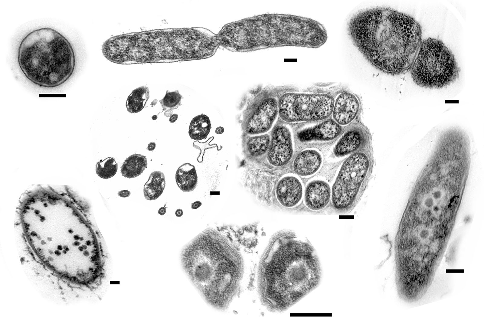 David Furness: Bevy of bacteria