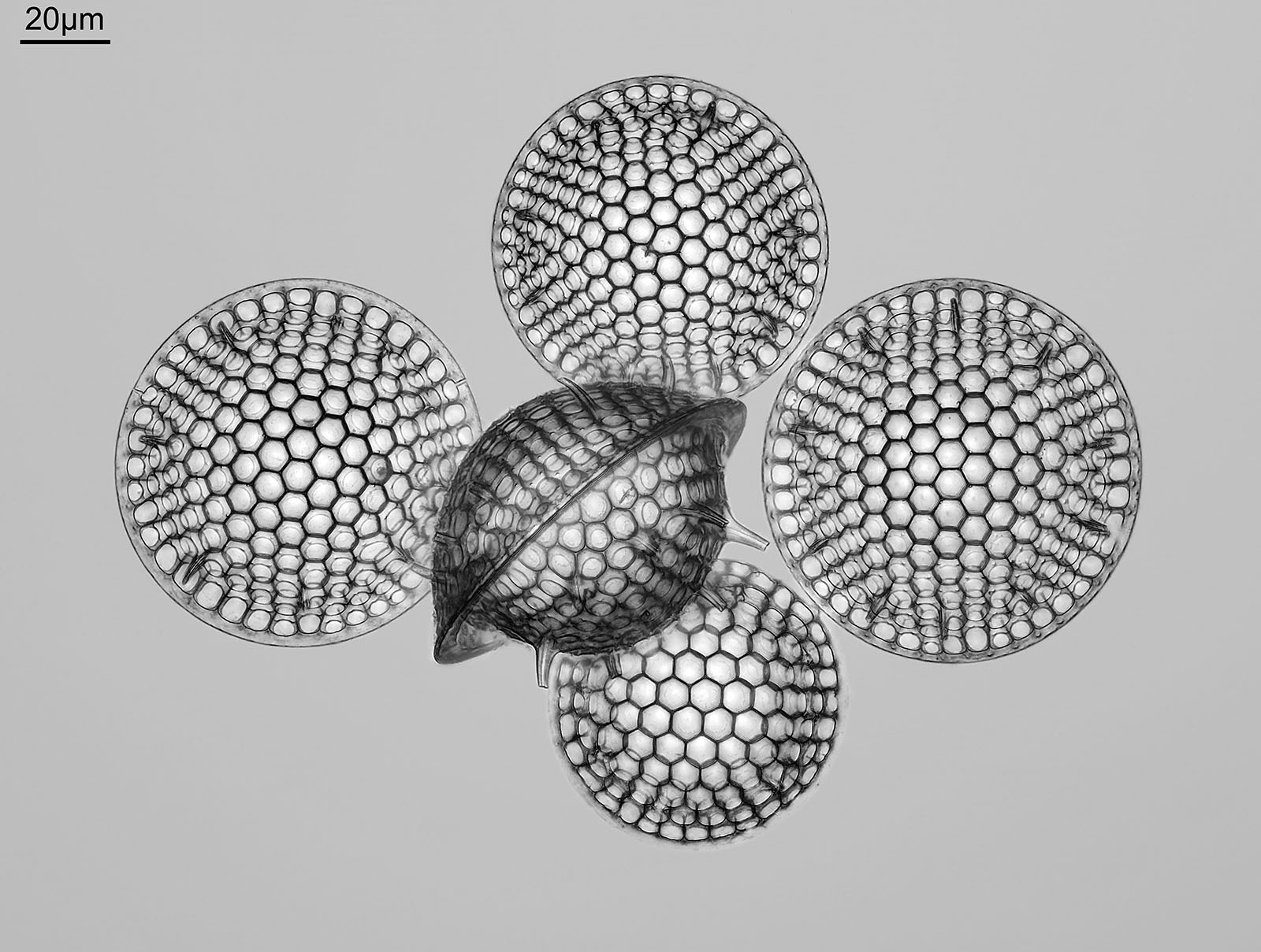 Jonathan Crowther: Stephanopyxis grunowii.