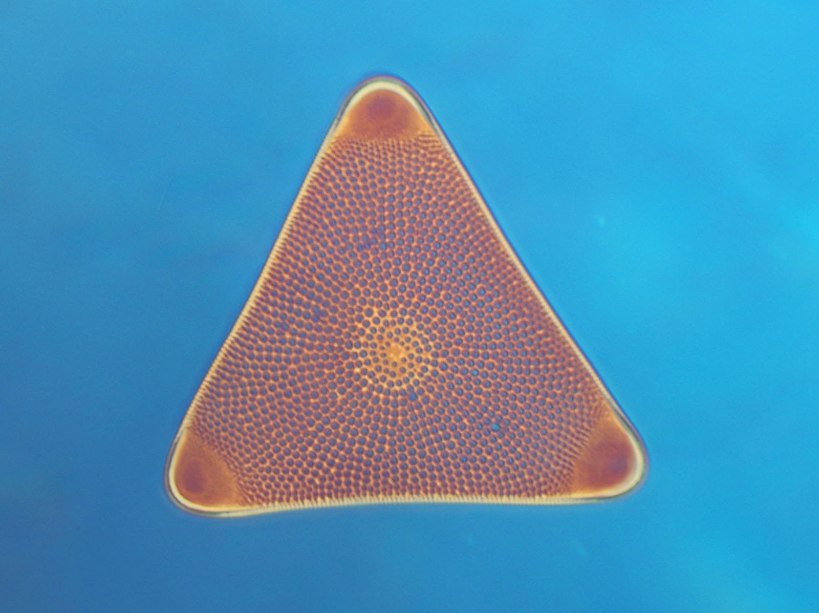 Phil Greaves: The diatom Triceratium arcticum.